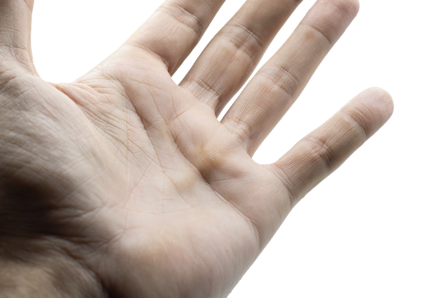 Handtherapie