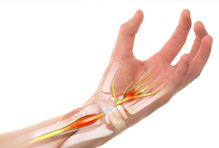 Handtherapie
