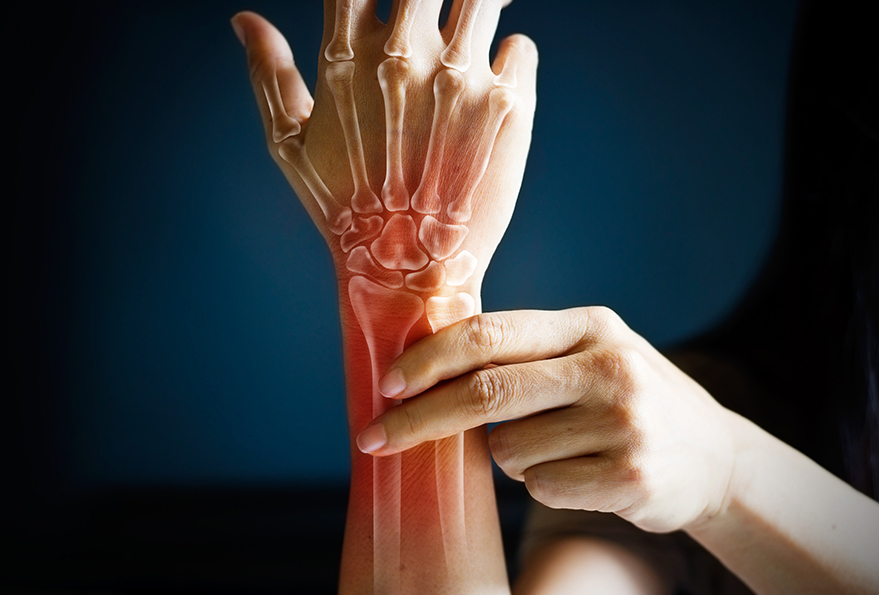 Handtherapie