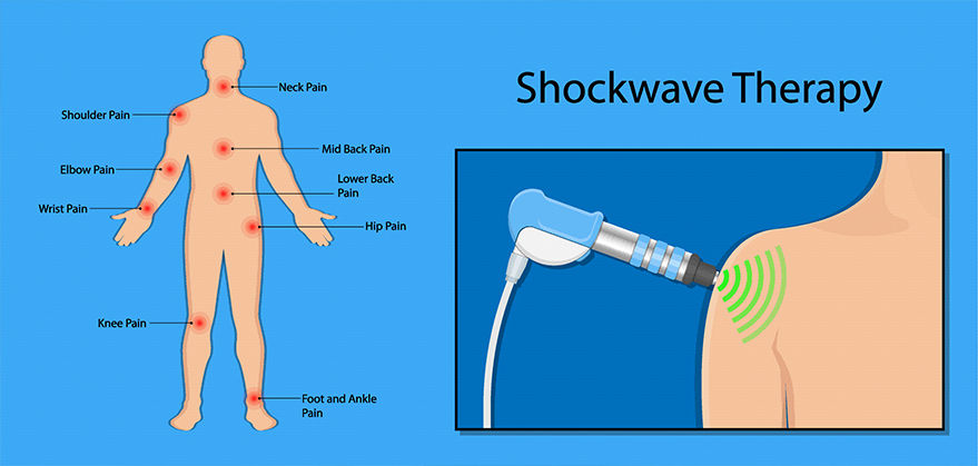 shockwave